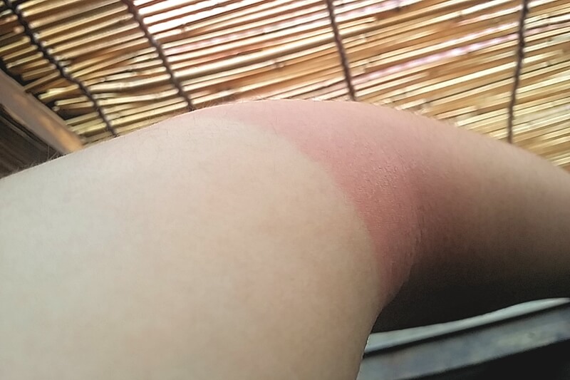 サイクリングで日焼けした腕